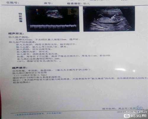 广州代孕网,输卵管的检查方法有哪些，优点和弊