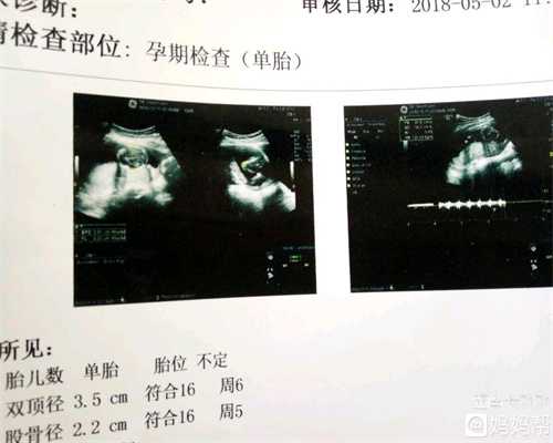 上海代孕产子,武汉多囊患者应该怎样做才能迎来