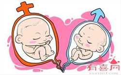 双胞胎杭州代生,警惕现代生活方式导致不孕症