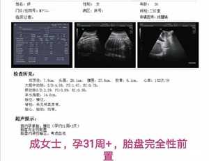 济南试管代生，香港卵巢早衰供卵